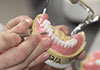 Dentures and Partials Reline